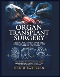 ORGAN TRANSPLANT SURGERY: A Practical Clinical Guide for Surgeons, Residents, ICU Doctors and Transplant Nurses, Step-by-Step Kidney, Liver and Heart Transplant Procedures, Patient Care and Complicati